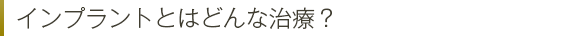 インプラントとはどんな治療?