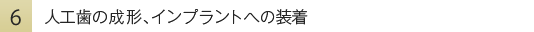 人工歯の成形、インプラントへの装着